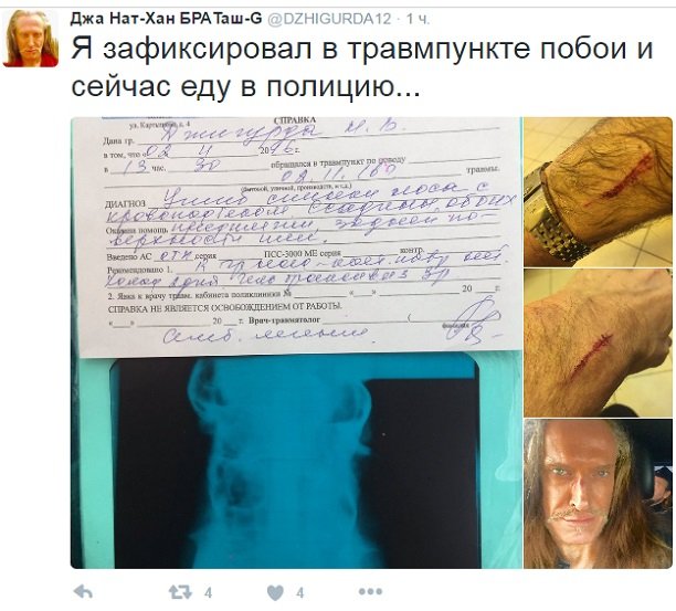 После драки с адвокатом Сергеем Жориным Никита Джигурда поехал в травмпункт снимать побои